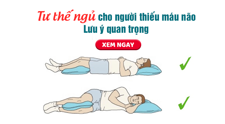 CÁC TƯ THẾ NGỦ TỐT CHO NGƯỜI THIẾU MÁU NÃO