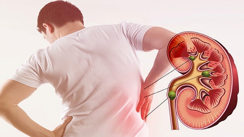 PHÂN BIỆT GIỮA ĐAU LƯNG DO THẬN YẾU VÀ ĐAU LƯNG DO XƯƠNG KHỚP
