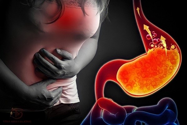 3 MẸO GIÚP TRỊ TRÀO NGƯỢC DẠ DÀY